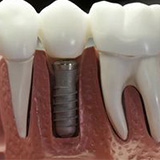 Ӣʽ��ʹ��ֲ������