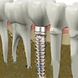 Ӣʽ��ʹ��ֲ���Ŀ�չ